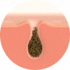 Unclogs Pores & Controls Oil