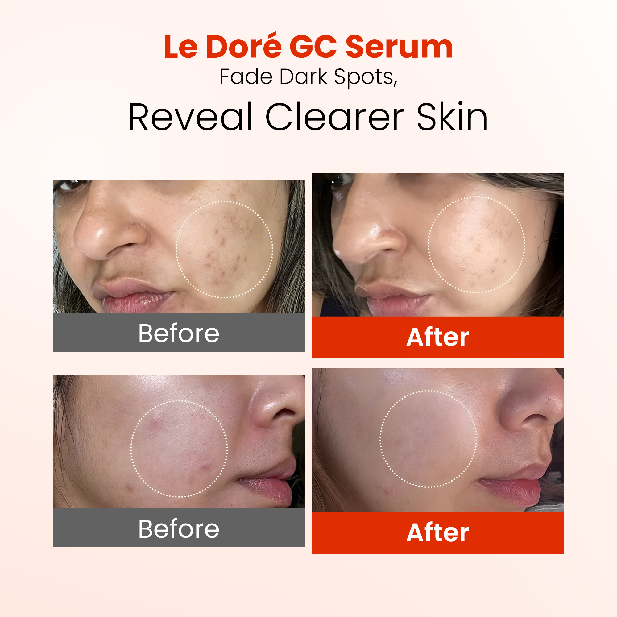 GC Serum